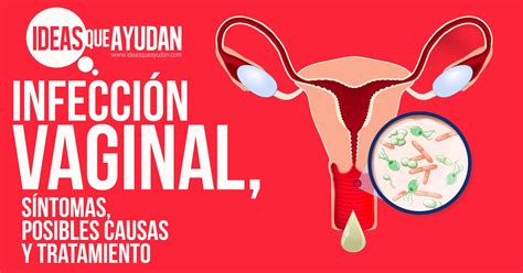 infeccion vajinal fotos reales|Cómo curar una infección vaginal: 15 Pasos (con imágenes)